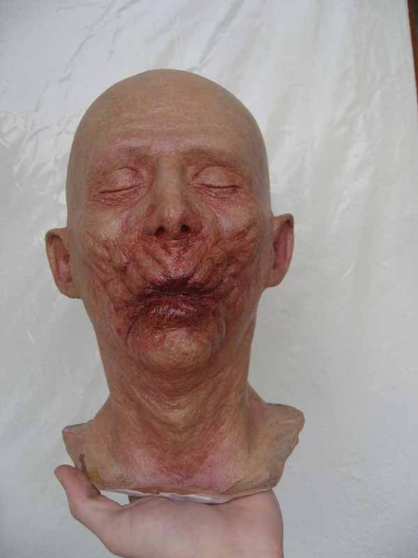 herpes5.jpg