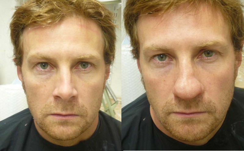 depardieu jeune 1.jpg